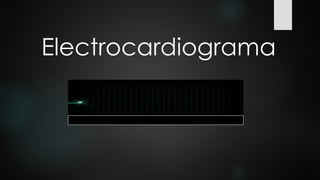 Electrocardiograma
 
