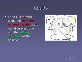 medics.cc
medics.cc
medics.cc
medics.cc
medics.cc
medics.cc
Leads
Leads
ƒ
ƒ Lead II is formed
Lead II is formed
using the
using the right arm
right arm
electrode (red)
electrode (red) as the
as the
negative electrode
negative electrode
and the
and the left leg
left leg
electrode
electrode as the
as the
positive
positive
Lead II
 
