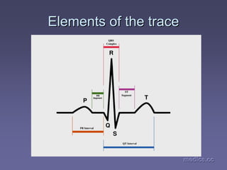 medics.cc
medics.cc
medics.cc
medics.cc
medics.cc
medics.cc
Elements of the trace
Elements of the trace
 