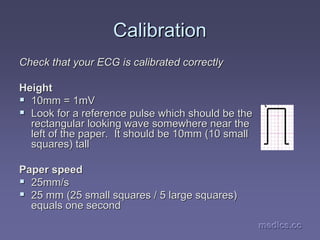 medics.cc
medics.cc
medics.cc
medics.cc
medics.cc
medics.cc
Calibration
Calibration
Check that your ECG is calibrated correctly
Check that your ECG is calibrated correctly
Height
Height
ƒ
ƒ 10mm = 1mV
10mm = 1mV
ƒ
ƒ Look for a reference pulse which should be the
Look for a reference pulse which should be the
rectangular looking wave somewhere near the
rectangular looking wave somewhere near the
left of the paper. It should be 10mm (10 small
left of the paper. It should be 10mm (10 small
squares) tall
squares) tall
Paper speed
Paper speed
ƒ
ƒ 25mm/s
25mm/s
ƒ
ƒ 25 mm (25 small squares / 5 large squares)
25 mm (25 small squares / 5 large squares)
equals one second
equals one second
 