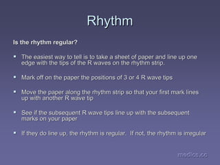 medics.cc
medics.cc
medics.cc
medics.cc
medics.cc
medics.cc
Rhythm
Rhythm
Is the rhythm regular?
Is the rhythm regular?
ƒ
ƒ The easiest way to tell is to take a sheet of paper and line up
The easiest way to tell is to take a sheet of paper and line up one
one
edge with the tips of the R waves on the rhythm strip.
edge with the tips of the R waves on the rhythm strip.
ƒ
ƒ Mark off on the paper the positions of 3 or 4 R wave tips
Mark off on the paper the positions of 3 or 4 R wave tips
ƒ
ƒ Move the paper along the rhythm strip so that your first mark li
Move the paper along the rhythm strip so that your first mark lines
nes
up with another R wave tip
up with another R wave tip
ƒ
ƒ See if the subsequent R wave tips line up with the subsequent
See if the subsequent R wave tips line up with the subsequent
marks on your paper
marks on your paper
ƒ
ƒ If they do line up, the rhythm is regular. If not, the rhythm i
If they do line up, the rhythm is regular. If not, the rhythm is irregular
s irregular
 