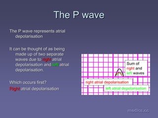 medics.cc
medics.cc
medics.cc
medics.cc
medics.cc
medics.cc
The P wave
The P wave
The P wave represents
The P wave represents atrial
atrial
depolarisation
depolarisation
It can be thought of as being
It can be thought of as being
made up of two separate
made up of two separate
waves due to
waves due to right
right atrial
atrial
depolarisation and
depolarisation and left
left atrial
atrial
depolarisation.
depolarisation.
Which occurs first?
Which occurs first?
Right
Right atrial
atrial depolarisation
depolarisation
right atrial depolarisation
Sum of
right and
left waves
left atrial depolarisation
 