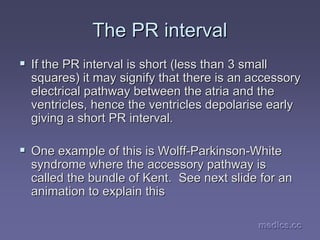 medics.cc
medics.cc
medics.cc
medics.cc
medics.cc
medics.cc
The PR interval
The PR interval
ƒ
ƒ If the PR interval is short (less than 3 small
If the PR interval is short (less than 3 small
squares) it may signify that there is an accessory
squares) it may signify that there is an accessory
electrical pathway between the atria and the
electrical pathway between the atria and the
ventricles, hence the ventricles depolarise early
ventricles, hence the ventricles depolarise early
giving a short PR interval.
giving a short PR interval.
ƒ
ƒ One example of this is Wolff
One example of this is Wolff-
-Parkinson
Parkinson-
-White
White
syndrome where the accessory pathway is
syndrome where the accessory pathway is
called the bundle of Kent. See next slide for an
called the bundle of Kent. See next slide for an
animation to explain this
animation to explain this
 