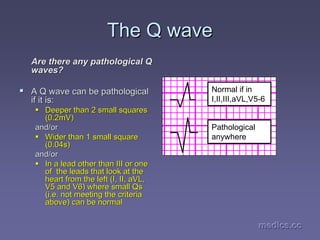 medics.cc
medics.cc
medics.cc
medics.cc
medics.cc
medics.cc
The Q wave
The Q wave
Are there any pathological Q
Are there any pathological Q
waves?
waves?
ƒ
ƒ A Q wave can be pathological
A Q wave can be pathological
if it is:
if it is:
ƒ
ƒ Deeper than 2 small squares
Deeper than 2 small squares
(0.2mV)
(0.2mV)
and/or
and/or
ƒ
ƒ Wider than 1 small square
Wider than 1 small square
(0.04s)
(0.04s)
and/or
and/or
ƒ
ƒ In a lead other than III or one
In a lead other than III or one
of the leads that look at the
of the leads that look at the
heart from the left (I, II,
heart from the left (I, II, aVL
aVL,
,
V5 and V6) where small Qs
V5 and V6) where small Qs
(i.e. not meeting the criteria
(i.e. not meeting the criteria
above) can be normal
above) can be normal
Normal if in
I,II,III,aVL,V5-6
Pathological
anywhere
 