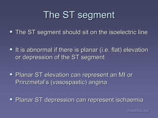 medics.cc
medics.cc
medics.cc
medics.cc
medics.cc
medics.cc
The ST segment
The ST segment
ƒ
ƒ The ST segment should sit on the
The ST segment should sit on the isoelectric
isoelectric line
line
ƒ
ƒ It is abnormal if there is planar (i.e. flat) elevation
It is abnormal if there is planar (i.e. flat) elevation
or depression of the ST segment
or depression of the ST segment
ƒ
ƒ Planar ST elevation can represent an MI or
Planar ST elevation can represent an MI or
Prinzmetal
Prinzmetal’
’s
s (
(vasospastic
vasospastic) angina
) angina
ƒ
ƒ Planar ST depression can represent
Planar ST depression can represent ischaemia
ischaemia
 