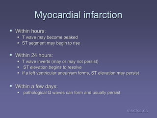 medics.cc
medics.cc
medics.cc
medics.cc
medics.cc
medics.cc
Myocardial infarction
Myocardial infarction
ƒ
ƒ Within hours:
Within hours:
ƒ
ƒ T wave may become peaked
T wave may become peaked
ƒ
ƒ ST segment may begin to rise
ST segment may begin to rise
ƒ
ƒ Within 24 hours:
Within 24 hours:
ƒ
ƒ T wave inverts (may or may not persist)
T wave inverts (may or may not persist)
ƒ
ƒ ST elevation begins to resolve
ST elevation begins to resolve
ƒ
ƒ If a left ventricular aneurysm forms, ST elevation may persist
If a left ventricular aneurysm forms, ST elevation may persist
ƒ
ƒ Within a few days:
Within a few days:
ƒ
ƒ pathological Q waves can form and usually persist
pathological Q waves can form and usually persist
 
