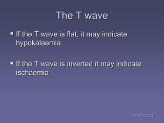 medics.cc
medics.cc
medics.cc
medics.cc
medics.cc
medics.cc
The T wave
The T wave
ƒ
ƒ If the T wave is flat, it may indicate
If the T wave is flat, it may indicate
hypokalaemia
hypokalaemia
ƒ
ƒ If the T wave is inverted it may indicate
If the T wave is inverted it may indicate
ischaemia
ischaemia
 