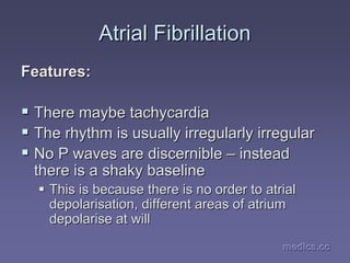 medics.cc
medics.cc
medics.cc
medics.cc
medics.cc
medics.cc
Atrial
Atrial Fibrillation
Fibrillation
Features:
Features:
ƒ
ƒ There maybe tachycardia
There maybe tachycardia
ƒ
ƒ The rhythm is usually irregularly irregular
The rhythm is usually irregularly irregular
ƒ
ƒ No P waves are discernible
No P waves are discernible –
– instead
instead
there is a shaky baseline
there is a shaky baseline
ƒ
ƒ This is because there is no order to
This is because there is no order to atrial
atrial
depolarisation, different areas of atrium
depolarisation, different areas of atrium
depolarise at will
depolarise at will
 