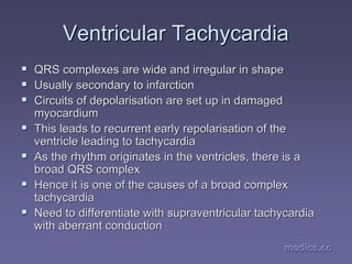 medics.cc
medics.cc
medics.cc
medics.cc
medics.cc
medics.cc
Ventricular Tachycardia
Ventricular Tachycardia
ƒ
ƒ QRS complexes are wide and irregular in shape
QRS complexes are wide and irregular in shape
ƒ
ƒ Usually secondary to infarction
Usually secondary to infarction
ƒ
ƒ Circuits of depolarisation are set up in damaged
Circuits of depolarisation are set up in damaged
myocardium
myocardium
ƒ
ƒ This leads to recurrent early repolarisation of the
This leads to recurrent early repolarisation of the
ventricle leading to tachycardia
ventricle leading to tachycardia
ƒ
ƒ As the rhythm originates in the ventricles, there is a
As the rhythm originates in the ventricles, there is a
broad QRS complex
broad QRS complex
ƒ
ƒ Hence it is one of the causes of a broad complex
Hence it is one of the causes of a broad complex
tachycardia
tachycardia
ƒ
ƒ Need to differentiate with
Need to differentiate with supraventricular
supraventricular tachycardia
tachycardia
with aberrant conduction
with aberrant conduction
 