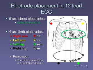 medics.cc
medics.cc
medics.cc
medics.cc
medics.cc
medics.cc
Electrode placement in 12 lead
Electrode placement in 12 lead
ECG
ECG
ƒ
ƒ 6 are chest electrodes
6 are chest electrodes
ƒ
ƒ Called V1
Called V1-
-6 or C1
6 or C1-
-6
6
ƒ
ƒ 4 are limb electrodes
4 are limb electrodes
ƒ
ƒ Right arm
Right arm R
Ride
ide
ƒ
ƒ Left arm
Left arm Y
Your
our
ƒ
ƒ Left leg
Left leg G
Green
reen
ƒ
ƒ Right leg
Right leg B
Bike
ike
ƒ
ƒ Remember
Remember
ƒ
ƒ The
The right leg
right leg electrode
electrode
is a neutral or
is a neutral or “
“dummy
dummy”
”!
!
 