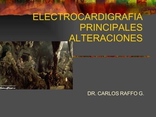 ELECTROCARDIGRAFIA PRINCIPALES ALTERACIONES DR. CARLOS RAFFO G. 