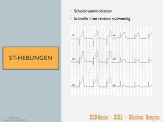 Fortbildung ZINA Kempten - EKG Basics für Notfallpflegende