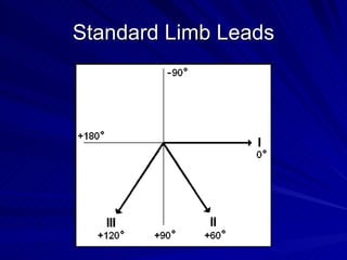 Standard Limb Leads 