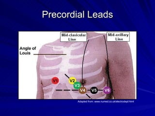 Precordial Leads Adapted from: www.numed.co.uk/electrodepl.html  