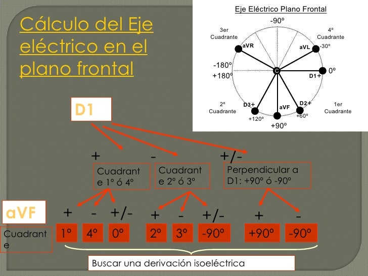 EKG - Eje electrico