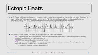 Random Ecg Comprehensive ECG Interpretation Guide: Clinical Review and Case ...
