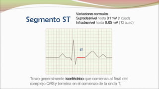 ST
Trazo generalmente isoeléctrico que comienza al final del
complejo QRSy termina en el comienzo de la onda T.
Variaciones normales:
Supradesnivel hasta 0.1 mV (1cuad)
Infradesnivel hasta 0.05 mV (1
/2 cuad)
 