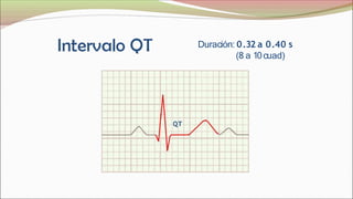 Duración: 0.32 a 0.40 s
(8 a 10cuad)
QT
 