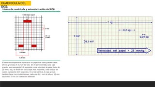 CUADRICULA DEL
EKG:
 