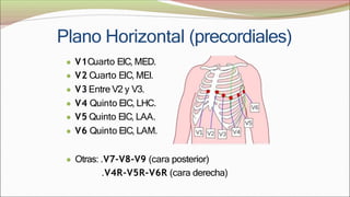 Plano Horizontal (precordiales)
● V1Cuarto EIC, MED.
● V2 Cuarto EIC, MEI.
● V3 Entre V2 y V3.
● V4 Quinto EIC, LHC.
● V5 Quinto EIC, LAA.
● V6 Quinto EIC, LAM.
● Otras: .V7-V8-V9 (cara posterior)
.V4R-V5R-V6R (cara derecha)
 