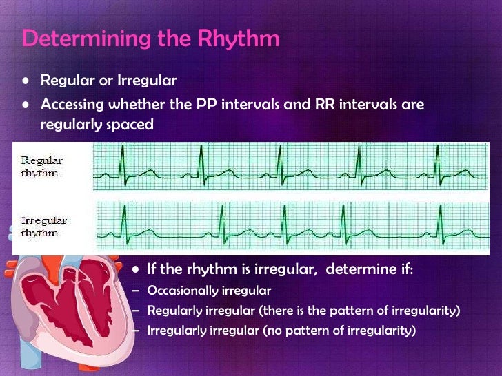 Ekg 12 leads