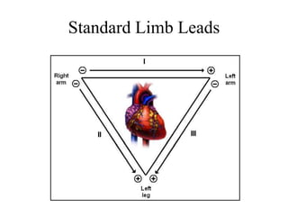 Standard Limb Leads
 