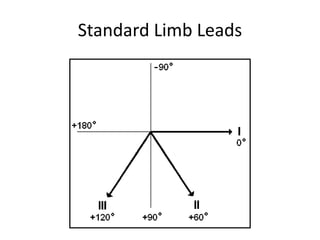 Standard Limb Leads
 