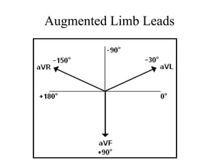 Augmented Limb Leads
 