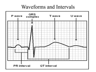 Waveforms and Intervals
 