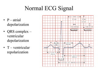 Normal ECG Signal
• P – atrial
depolarization
• QRS complex –
ventricular
depolarization
• T – ventricular
repolarization
 