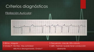 Criterios diagnósticos
Fibrilación Auricular:

 Ritmo : Irregular

 Frecuencia : mas de 100 x minuto

 Ondas P : No Hay . Hay actividad

 QRS : Normal / puede tener conducción

eléctrica desorganizada. Ondas F

aberrante

 