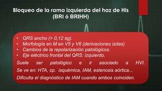 Bloqueo de la rama izquierda del haz de His
(BRI ó BRIHH)

•
•
•
•

QRS ancho (> 0,12 sg).
Morfología en M en V5 y V6 (derivaciones izdas)
Cambios de la repolarización patológicos.
Eje eléctrico frontal del QRS: izquierdo.

Suele

ser

patológico

e

ir

asociado

a

Se ve en: HTA, cp. isquémica, IAM, estenosis aórtica...
Dificulta el diagnóstico de IAM cuando ambos coinciden.

HVI.

 