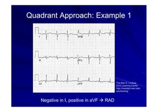 Rad Ecg Example ekg basics electro cardiogram English .pdf