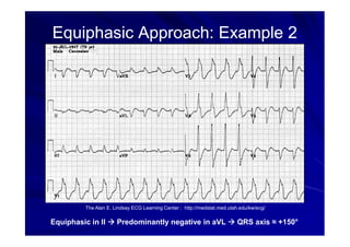 Simple Approach Ecg ekg basics electro cardiogram English .pdf