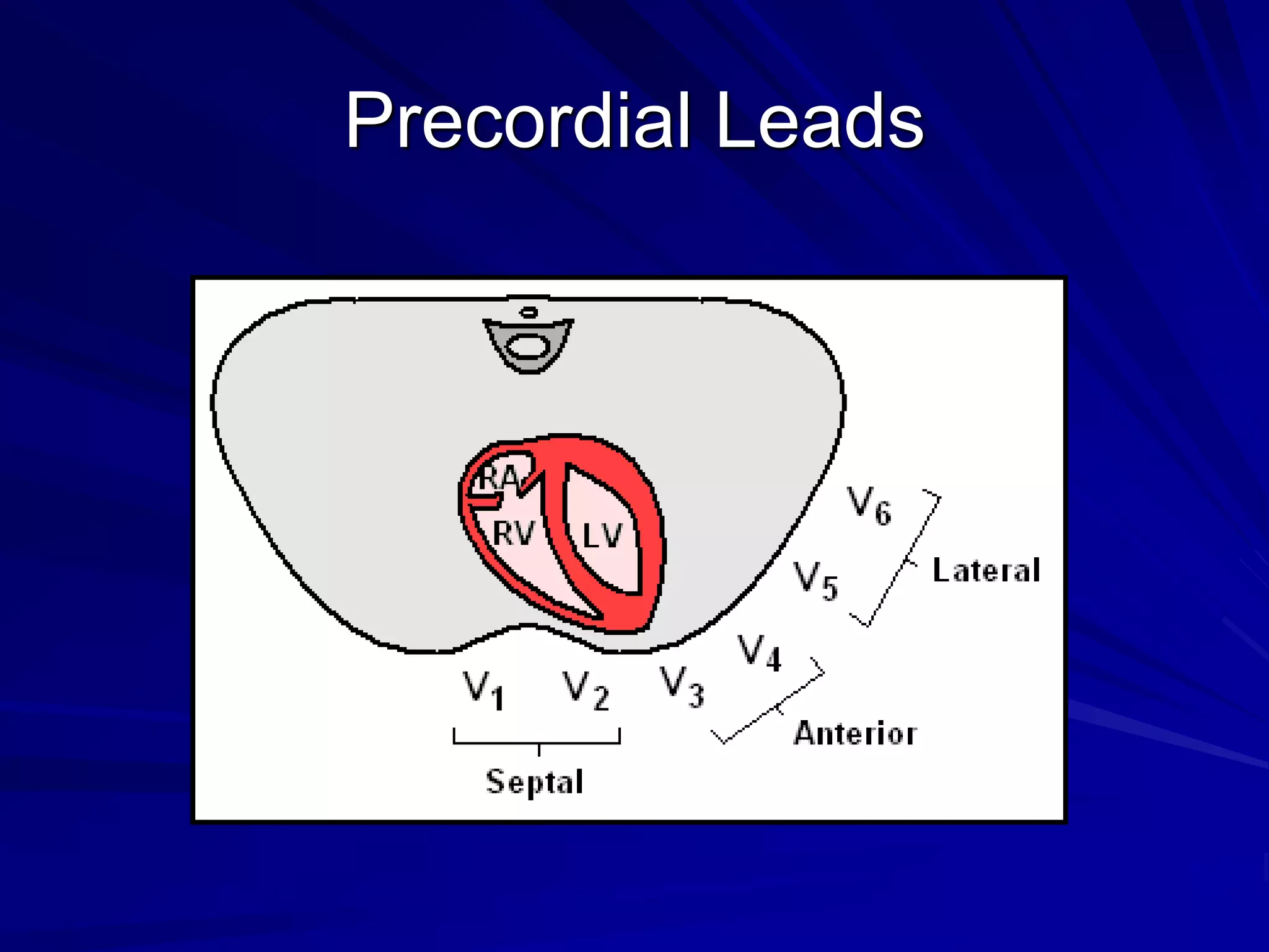 Precordial Leads
 