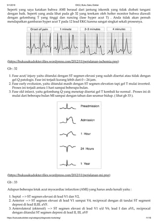 Ekg buku saku dokter | PDF