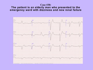 Case #30:
 The patient is an elderly man who presented to the
emergency ward with dizziness and new renal failure
 