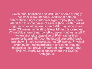 Given atrial fibrillation and RVH one should strongly
        consider mitral stenosis. Additional note on
 differentiating right ventricular hypertrophy (RVH) from
lateral MI: In some cases of severe (RVH) with marked
  right axis deviation, leads I and aVL may show rS or
even QS waves, simulating lateral MI. In this case, lead
V1 notably shows a narrow qR complex (not just a tall R
      wave) strongly suggestive of RVH, rather than
  posterior-lateral MI. Also, the lateral precordial leads
here show rS type complexes, not QR waves. Physical
     examination, echocardiogram and other imaging
   modalities also provide important information about
      RVH vs. lateral MI in cases where the ECG is
                          ambiguous.
 