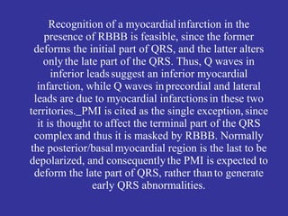 RBBB With Primary ST-T Wave Abnormalities
RBBB is recognized by 1) rR' in V1; 2) QRS duration >0.12s; 3) terminal QRS
  fo...