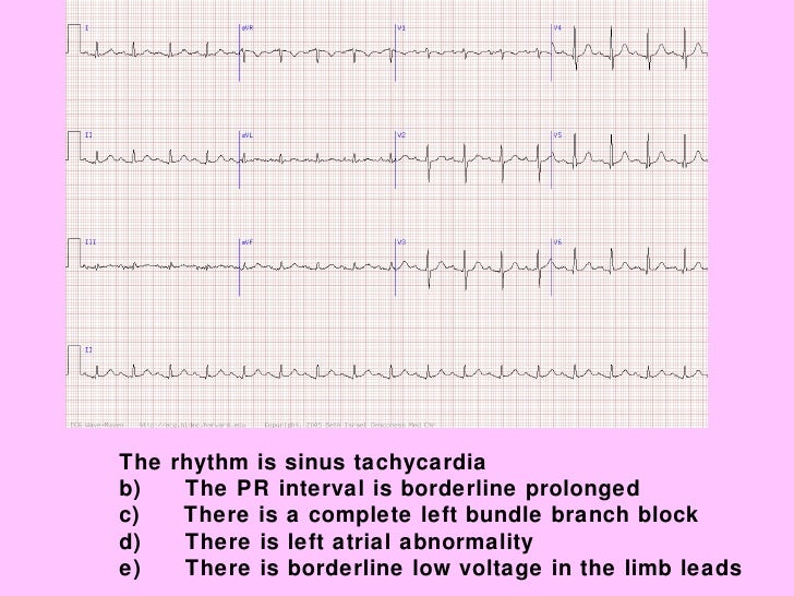 Ekg Cases Jul09.Level One Part 1