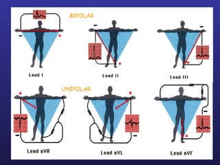 BIPOLAR




              UNIPOLAR




Jan 7, 2013               20
 
