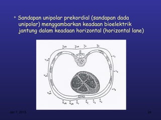 
      Sandapan unipolar prekordial (sandapan dada
      unipolar) menggambarkan keadaan bioelektrik
      jantung dalam keadaan horizontal (horizontal lane)




Jan 7, 2013                                                24
 