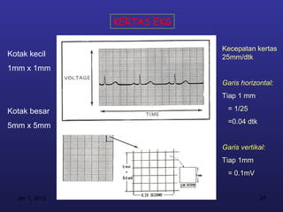 KERTAS EKG

                             Kecepatan kertas
Kotak kecil                  25mm/dtk
1mm x 1mm
                             Garis horizontal:
                             Tiap 1 mm

Kotak besar                    = 1/25
                               =0.04 dtk
5mm x 5mm

                             Garis vertikal:
                             Tiap 1mm
                               = 0.1mV


  Jan 7, 2013                              27
 