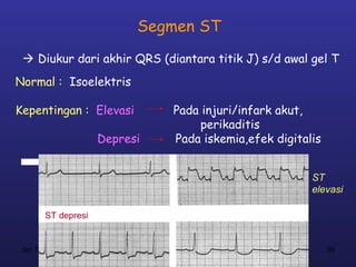 Segmen ST
  Diukur dari akhir QRS (diantara titik J) s/d awal gel T
Normal : Isoelektris

Kepentingan : Elevasi          Pada injuri/infark akut,
                                    perikaditis
                     Depresi   Pada iskemia,efek digitalis


                                                        ST
                                                        elevasi

        ST depresi


 Jan 7, 2013                                                 39
 