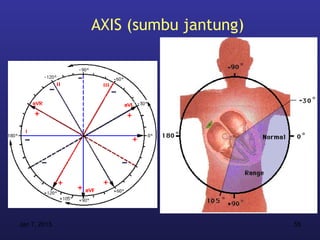 AXIS (sumbu jantung)




Jan 7, 2013                          55
 
