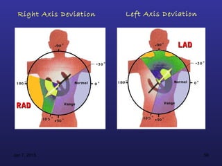 Right Axis Deviation   Left Axis Deviation



                                      LAD




 RAD




Jan 7, 2013                                    56
 