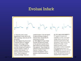 Evolusi Infark




Jan 7, 2013                    66
 