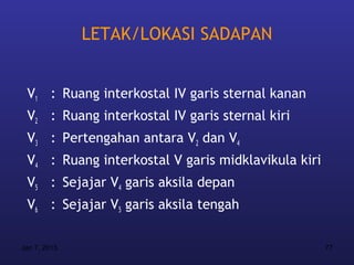 LETAK/LOKASI SADAPAN


 V1 : Ruang interkostal IV garis sternal kanan
 V2 : Ruang interkostal IV garis sternal kiri
 V3 : Pertengahan antara V2 dan V4
 V4 : Ruang interkostal V garis midklavikula kiri
 V5 : Sejajar V4 garis aksila depan
 V6 : Sejajar V5 garis aksila tengah

Jan 7, 2013                                         77
 