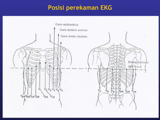 Posisi perekaman EKG




01/07/13                          78
 