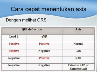 Cara cepat menentukan axis
Dengan melihat QRS